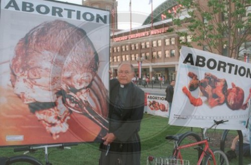 Abtreibung