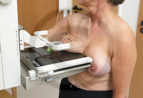 Mammografie - Untersuchung