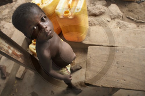 Hunger in Burkina Faso