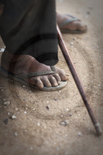 Die verschrumpelten Fuesse eines alten Mannes | The shriveled feet of an old man