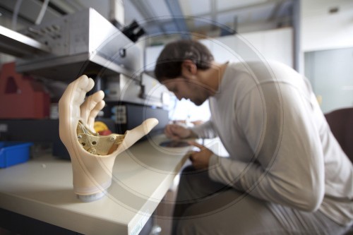 Entwicklung einer Handprothese an der Technischen Universitaet Hamburg - Harburg|Development of a hand prosthesis at the Technical University Hamburg - Harburg