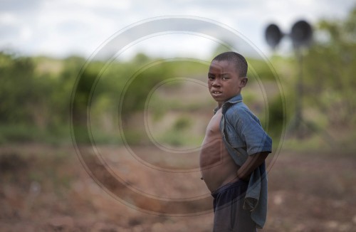 Wasserbauch afrikanischen kindern