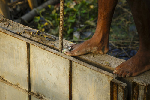Arbeiter mit verletztem Fuss auf einer Baustelle in Bangladesch