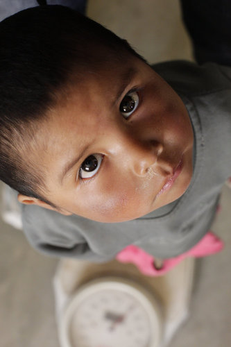 Mangelernaehrung bei Kindern in Boliven