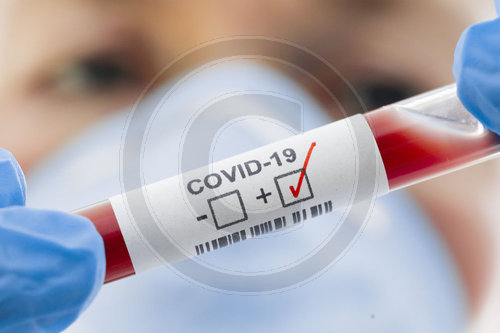 Coronavirus Diagnose