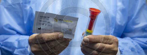 Diatropix Antigen Tests aus dem Senegal