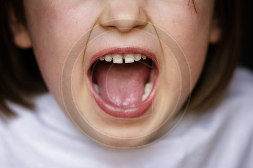 Schreiendes Kind